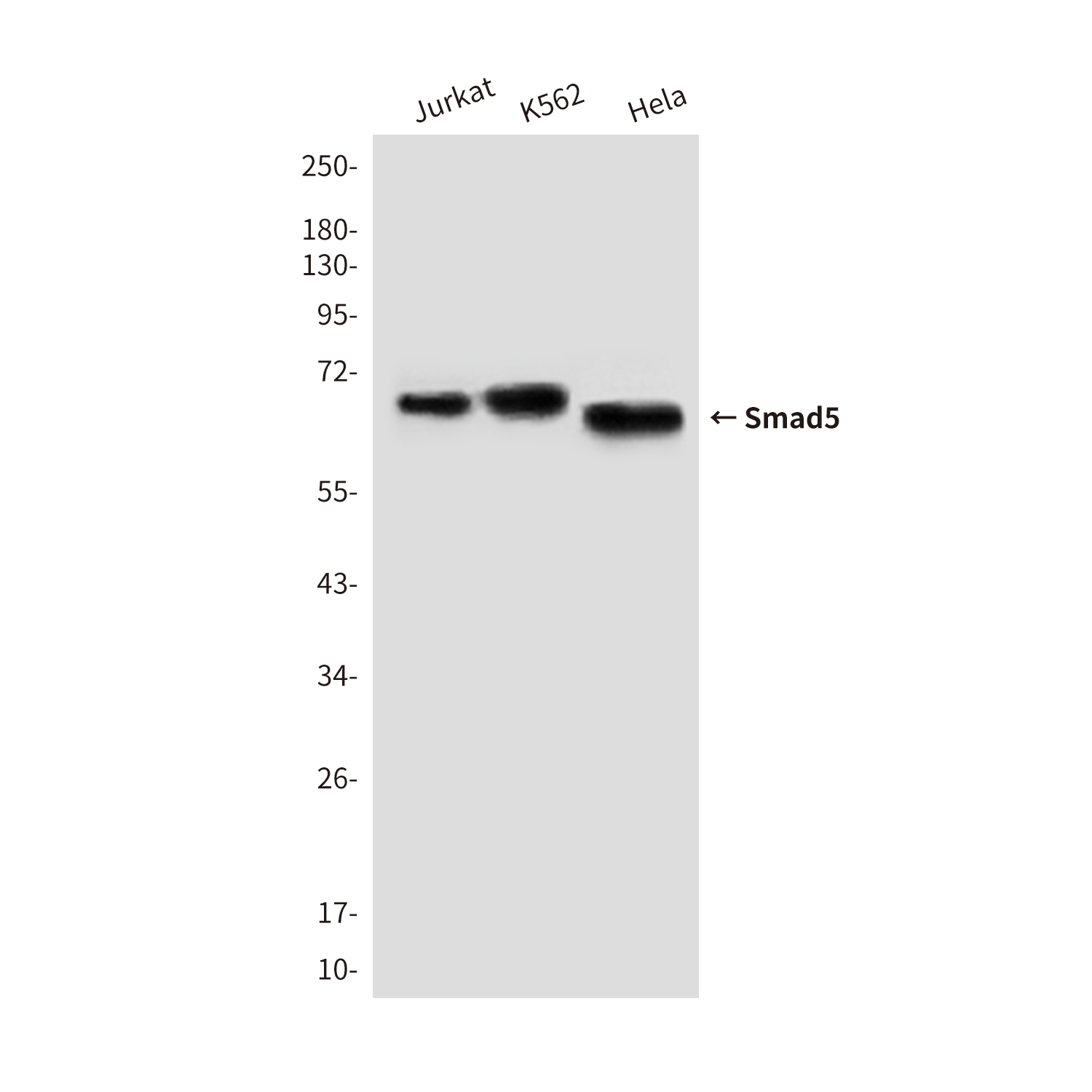 Smad5 (4B10) Mouse mAb ABZ3851