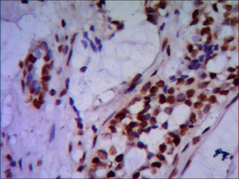 PRMT6 (2C3) Mouse mAb ABZ3856