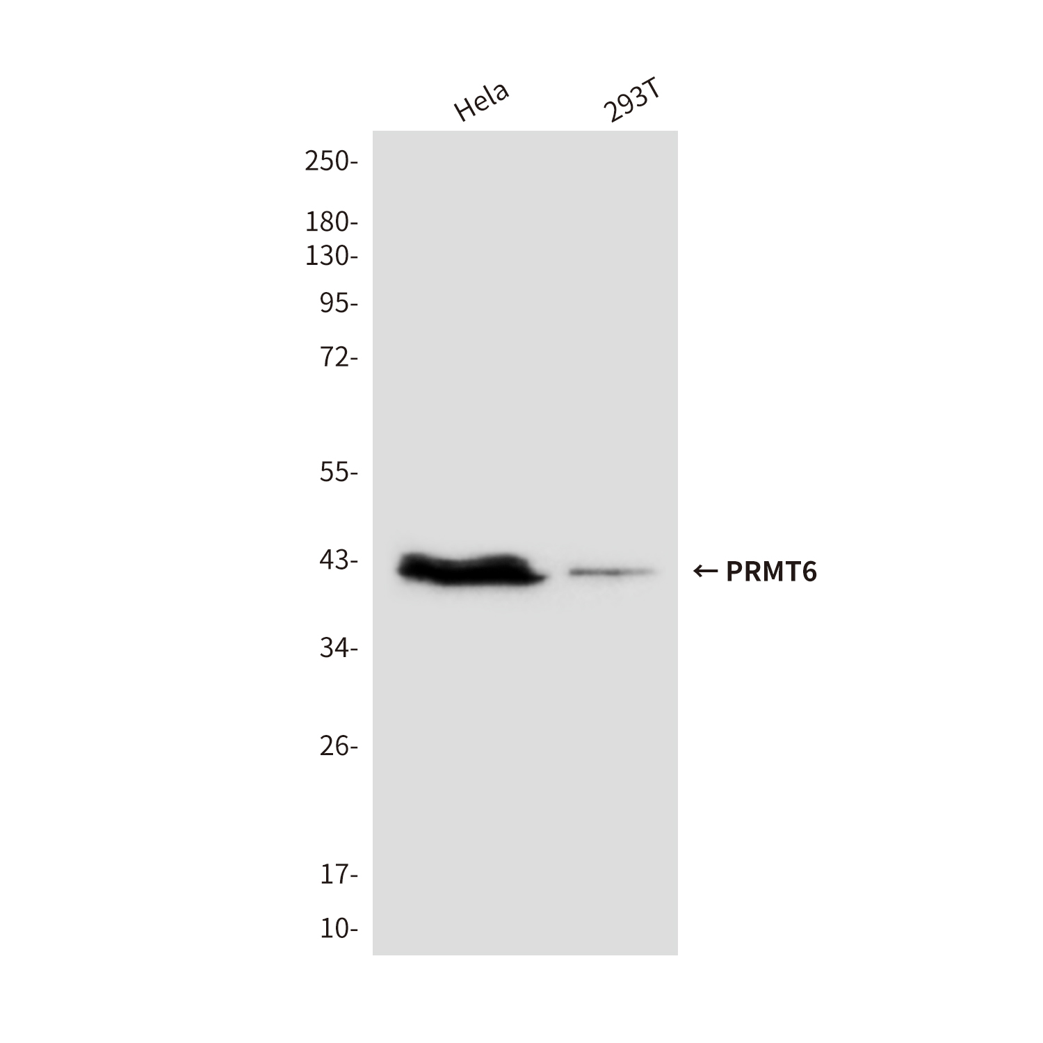 PRMT6 (2C3) Mouse mAb ABZ3856