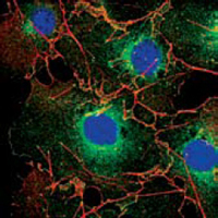 LPP (6F6) Mouse mAb ABZ3859
