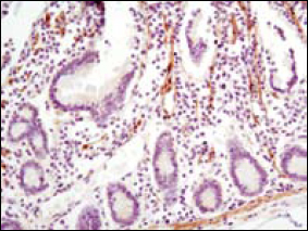 LPP (6F6) Mouse mAb ABZ3859