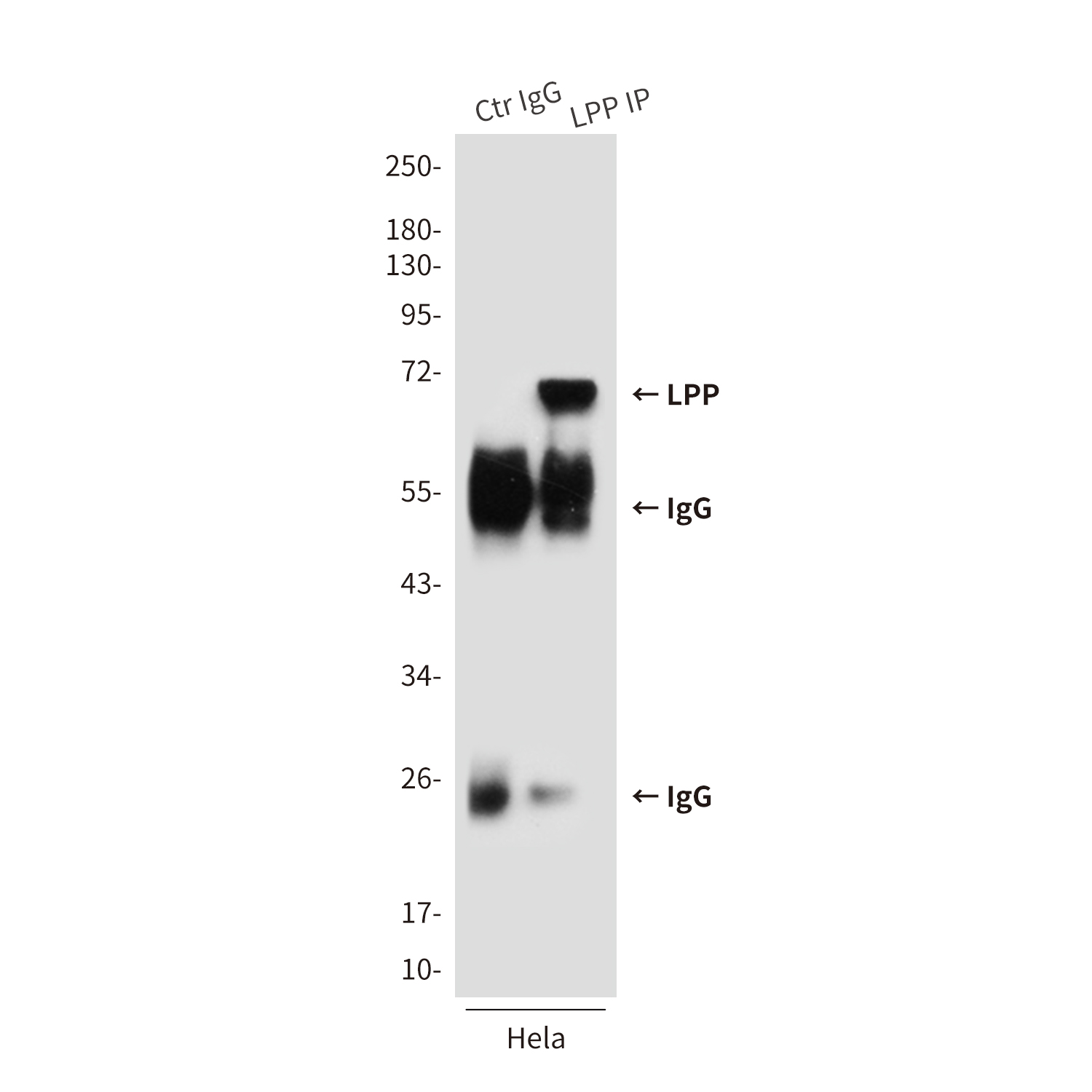 LPP (6F6) Mouse mAb ABZ3859