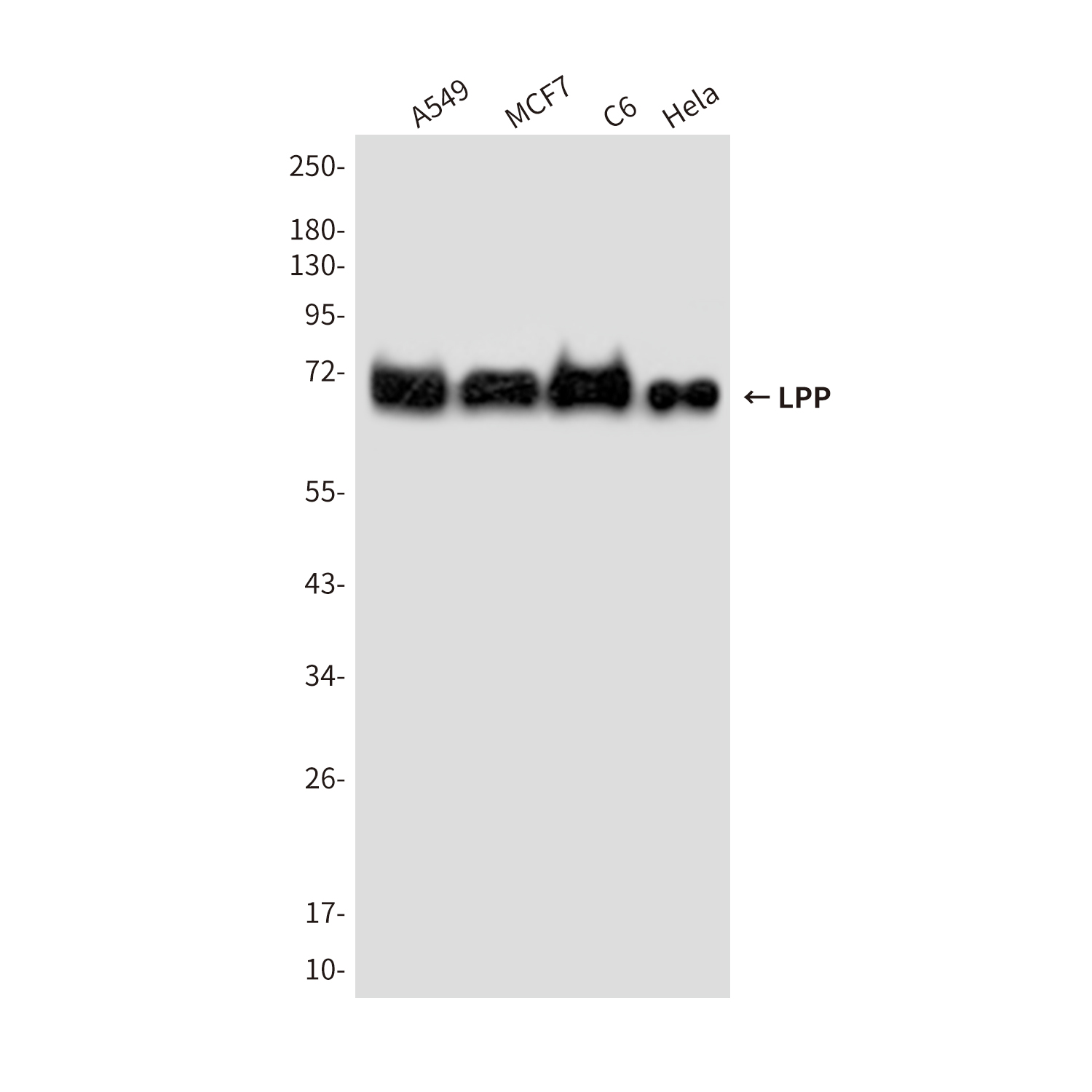 LPP (6F6) Mouse mAb ABZ3859