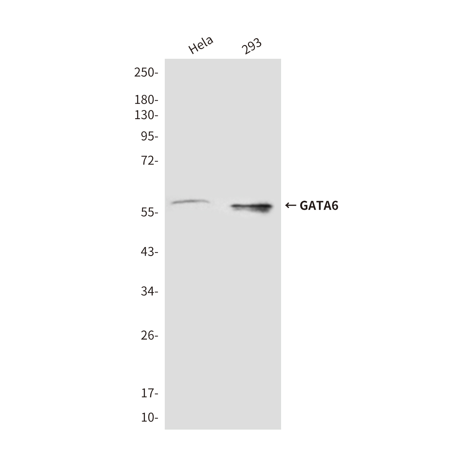 GATA6 (3H3) Mouse mAb ABZ3862