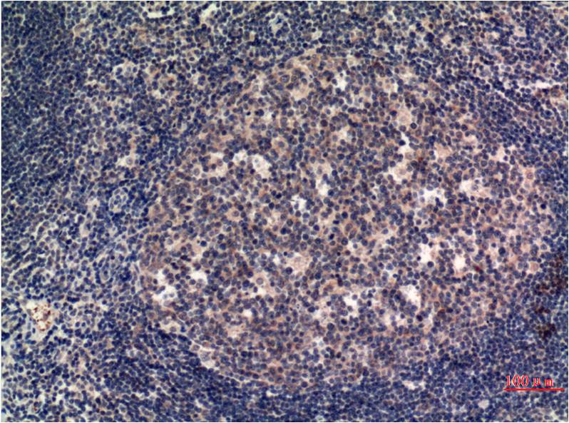 MLKL (5E3) Mouse mAb ABZ3864