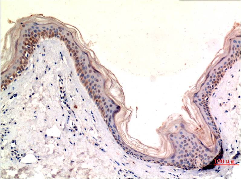 MLKL (5E3) Mouse mAb ABZ3864