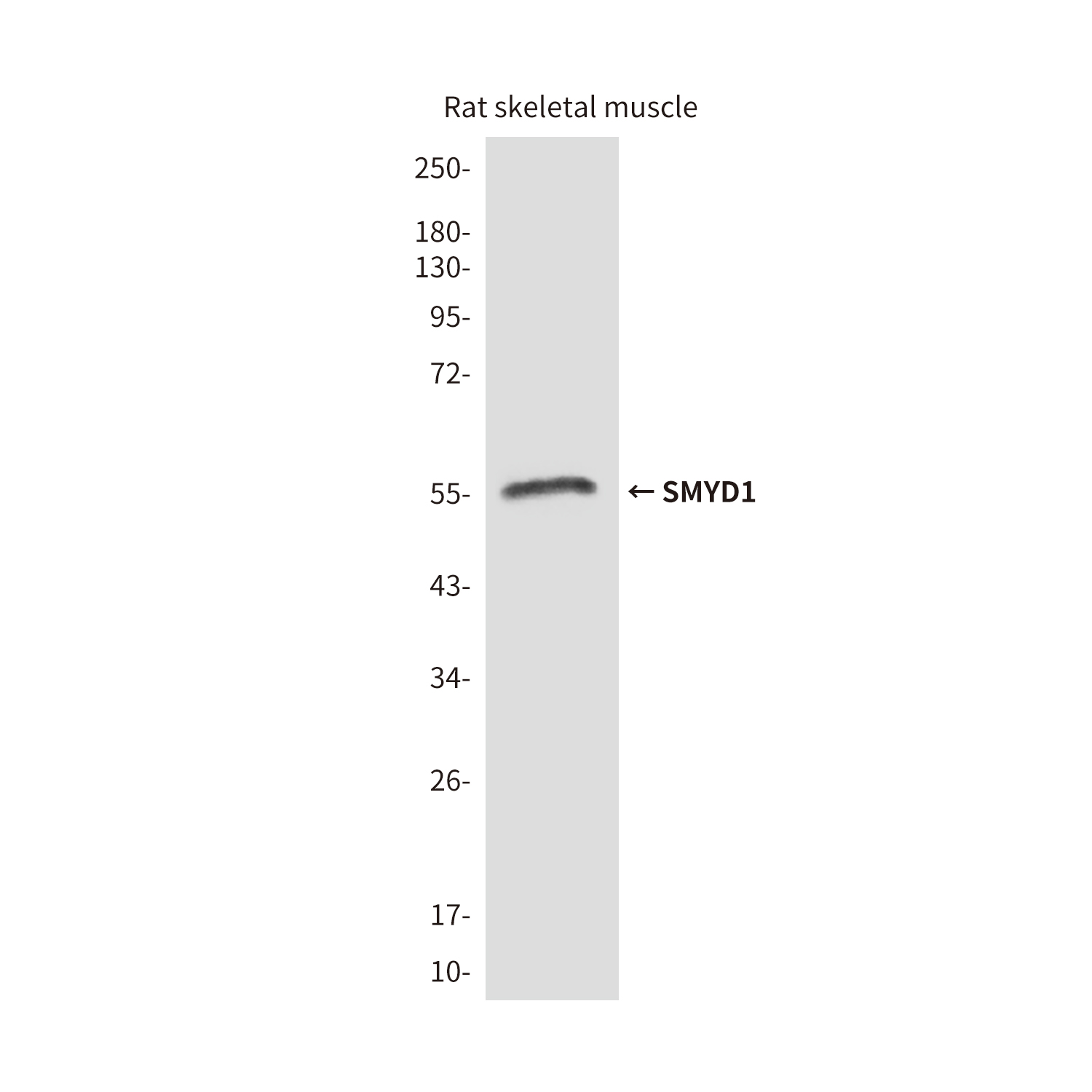 SMYD1 (2E11) Mouse mAb ABZ3865