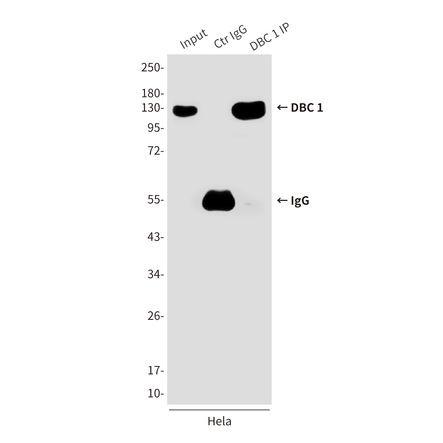 DBC 1 (3G4) Mouse mAb ABZ3867