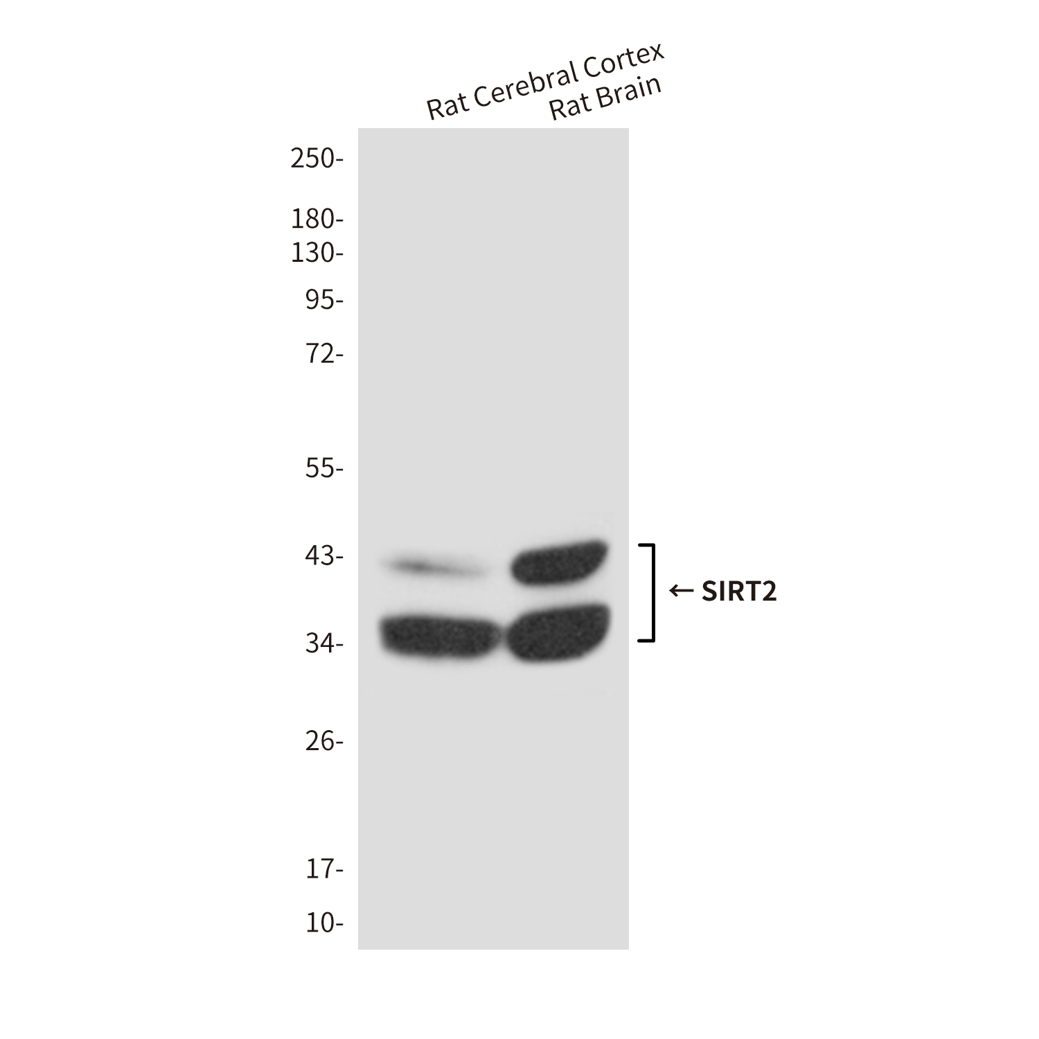 SIRT2 (1D4) Mouse mAb ABZ3868