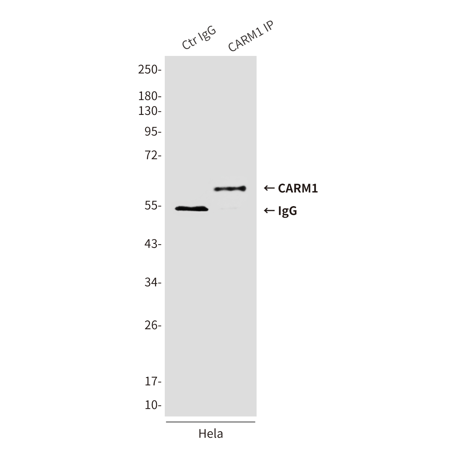 CARM1 (2B9) Mouse mAb ABZ3869