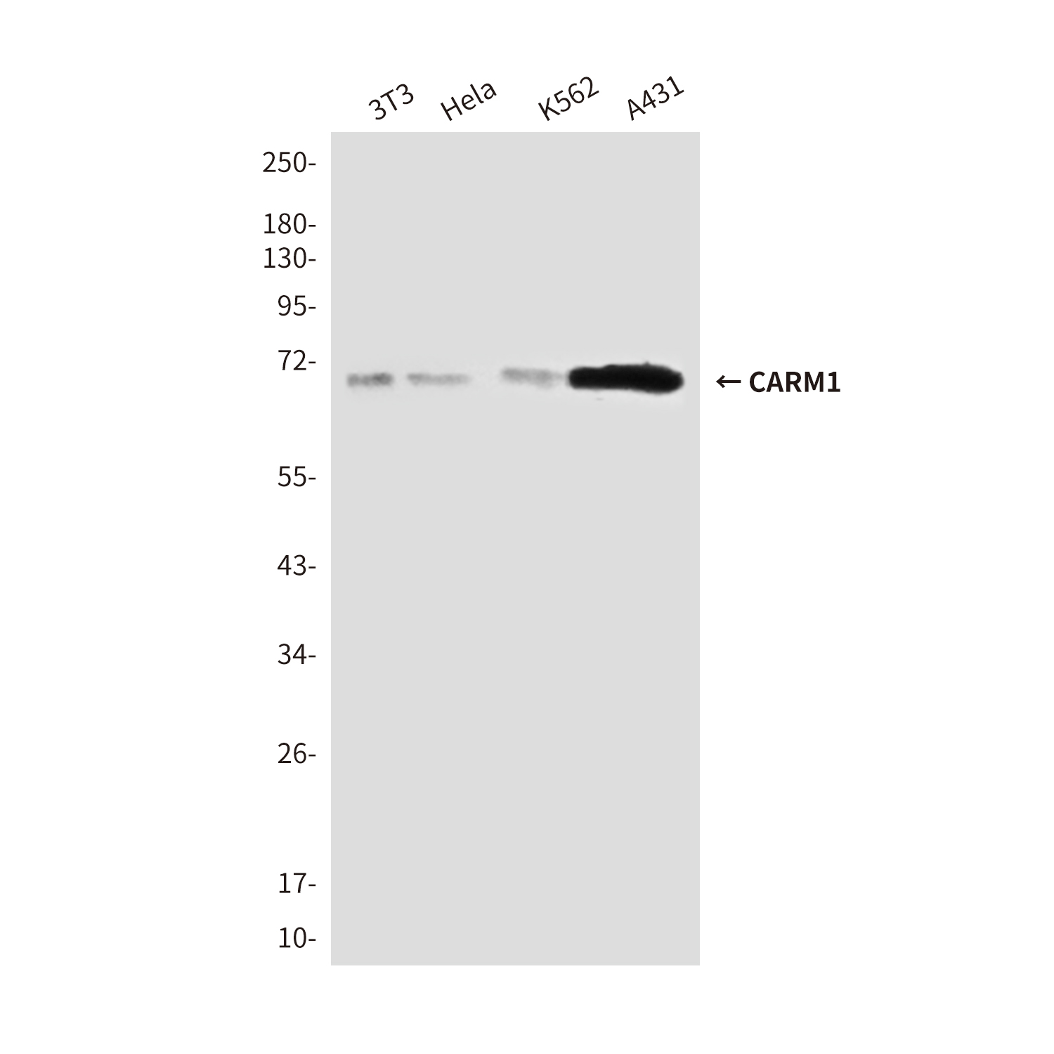 CARM1 (2B9) Mouse mAb ABZ3869