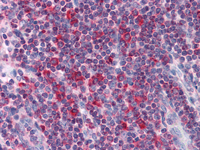 LYRIC/AEG1 (2E4) Mouse mAb ABZ3870