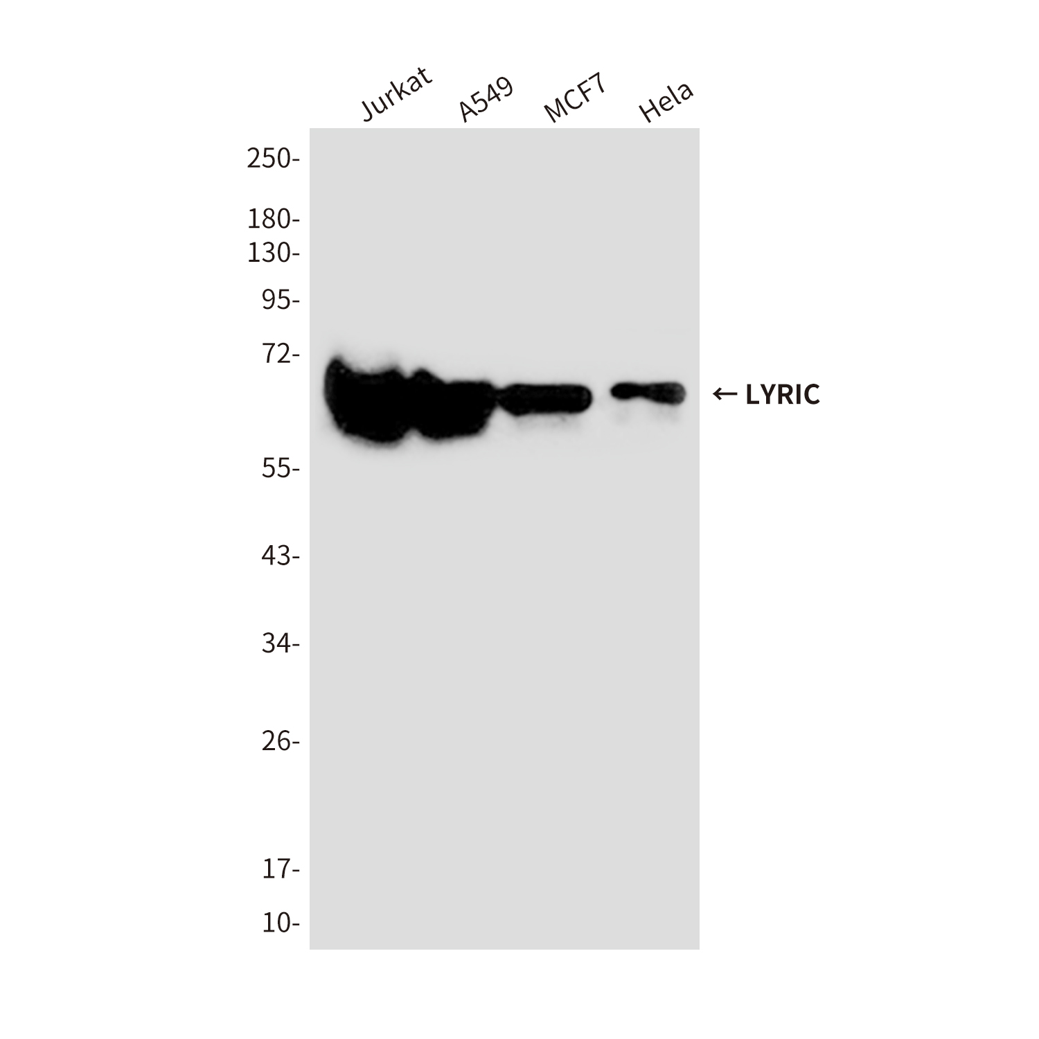 LYRIC/AEG1 (2E4) Mouse mAb ABZ3870