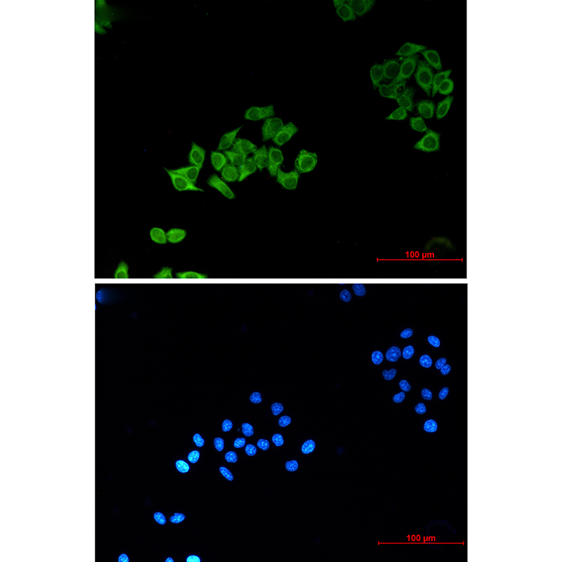 ABCB5 (8D2) Mouse mAb ABZ3875
