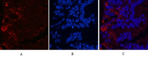 KIF7 (2A7) Mouse mAb ABZ3876
