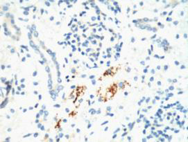 KIF7 (2A7) Mouse mAb ABZ3876