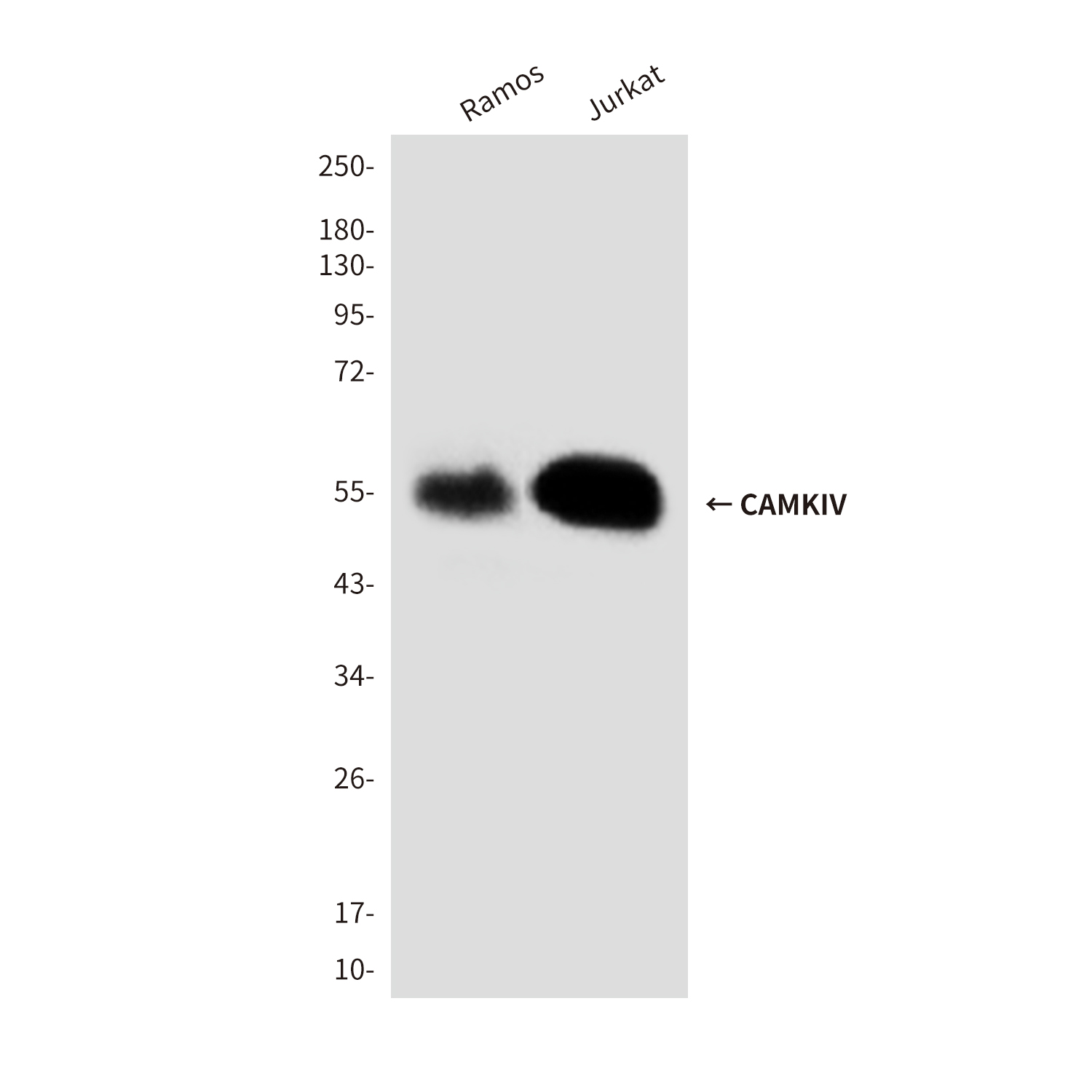 CAMKIV (3C10) Mouse mAb ABZ3877