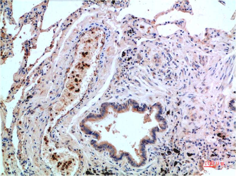 p38 MAPK (6F5) Mouse mAb ABZ3878