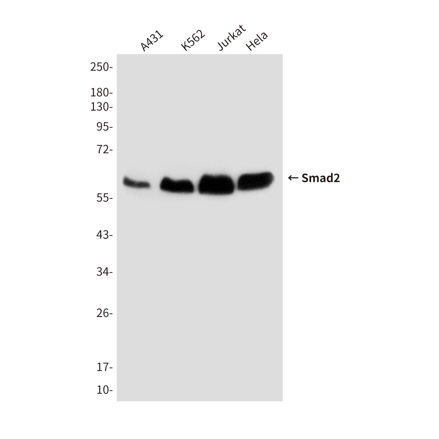 Smad2 (6H5) Mouse mAb ABZ3881