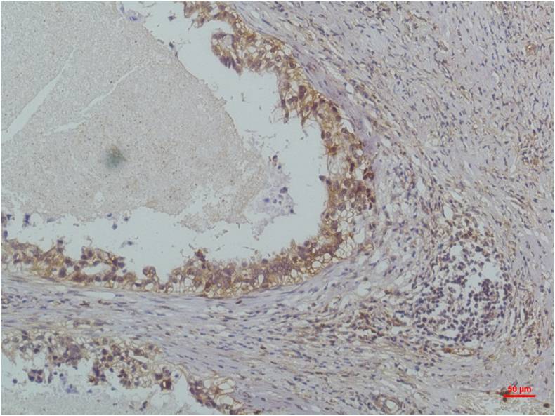IKB beta (5H3) Mouse mAb ABZ3882