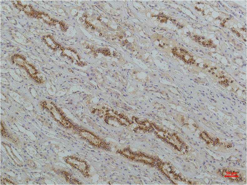 IKB beta (5H3) Mouse mAb ABZ3882