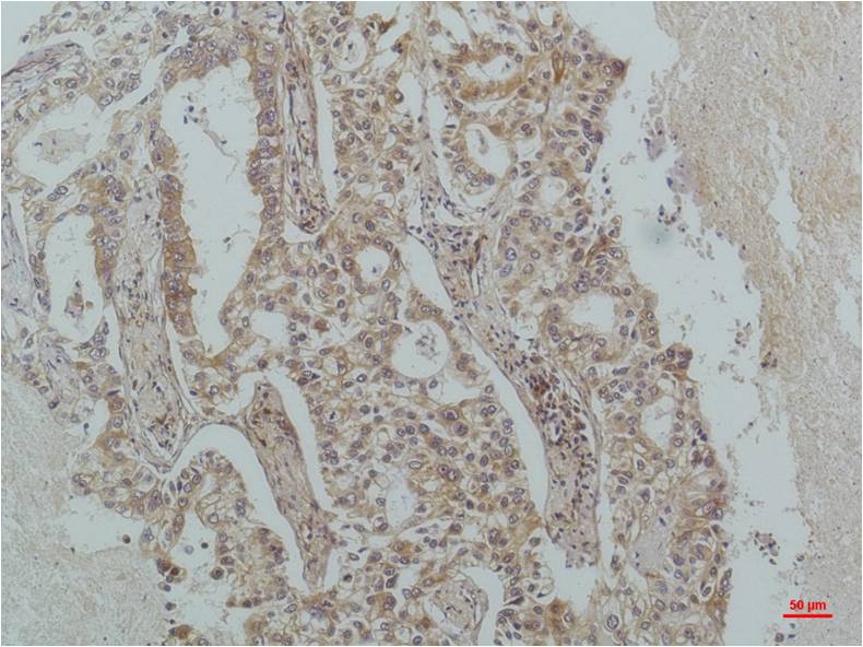 IKB beta (3H3) Mouse mAb ABZ3883