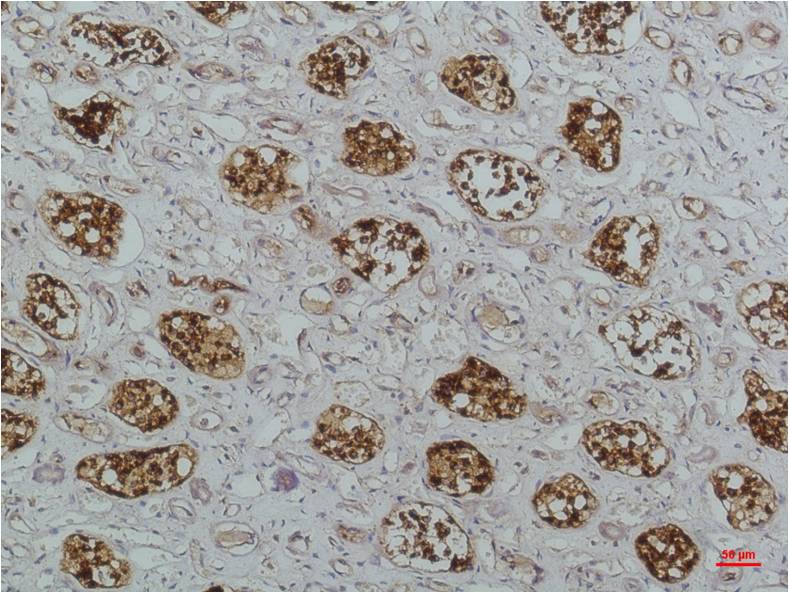 IKB beta (3H3) Mouse mAb ABZ3883