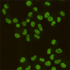SAFB1 (2E8) Mouse mAb ABZ3884