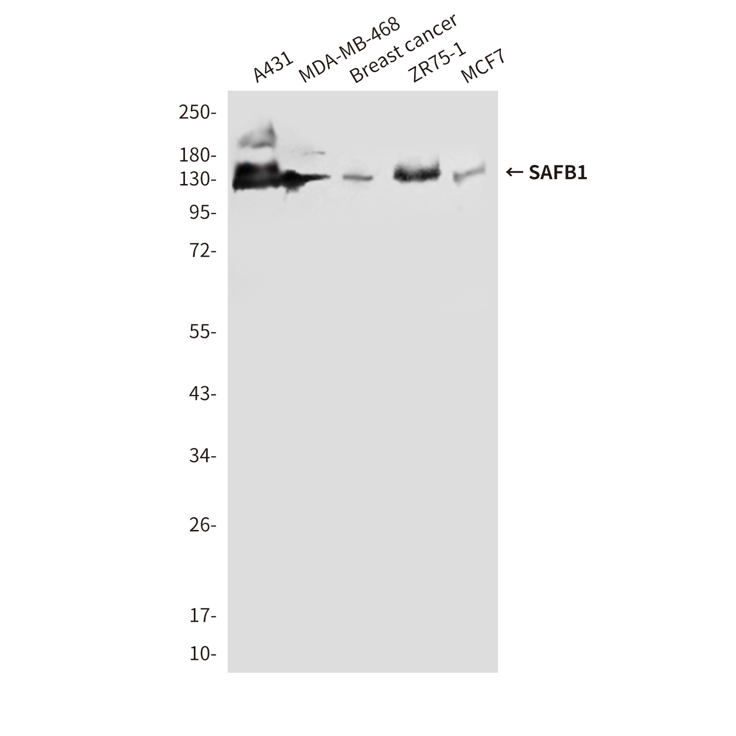 SAFB1 (2E8) Mouse mAb ABZ3884