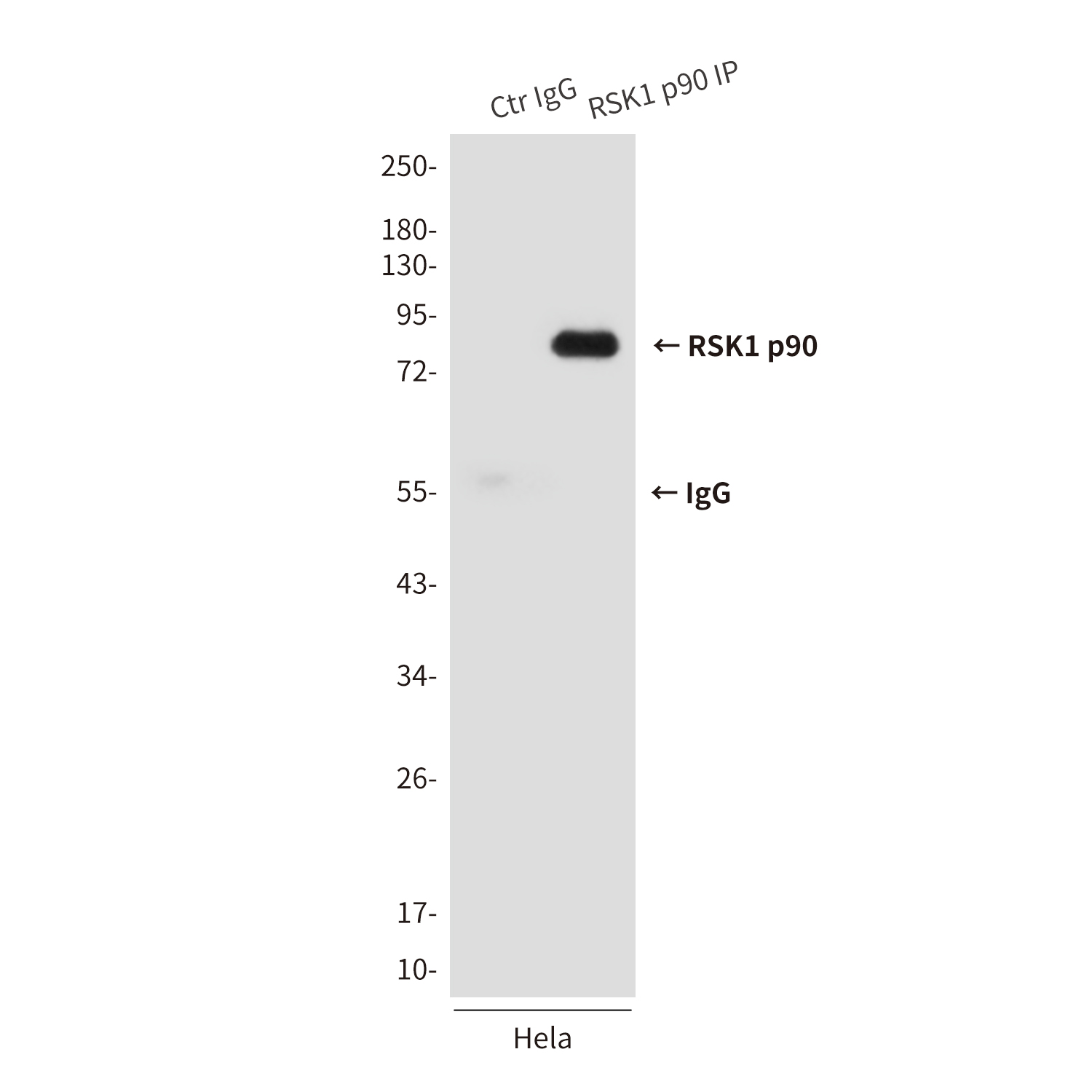 RSK1 p90 (6B9) Mouse mAb ABZ3885