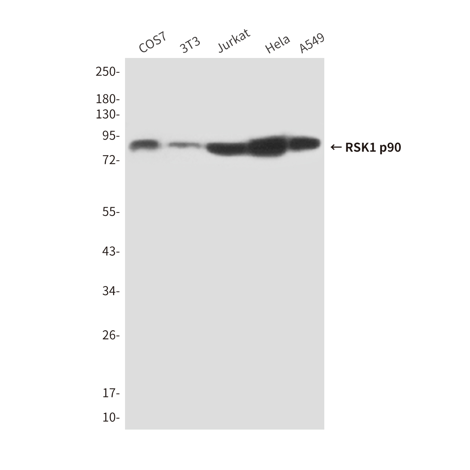 RSK1 p90 (6B9) Mouse mAb ABZ3885