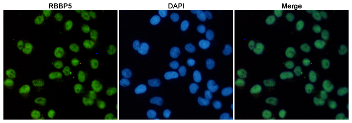 RBBP5 (1C9) Mouse mAb ABZ3886
