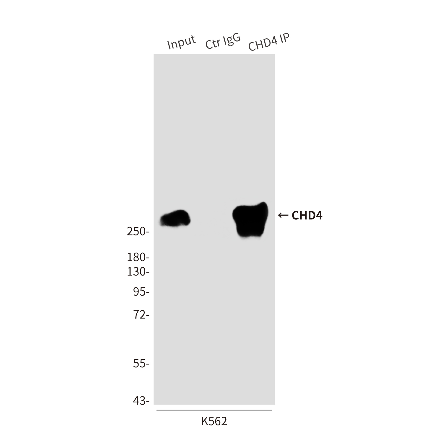 CHD4 (5F1) Mouse mAb ABZ3887