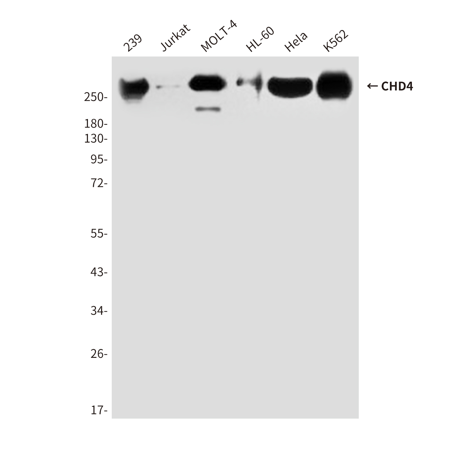 CHD4 (5F1) Mouse mAb ABZ3887