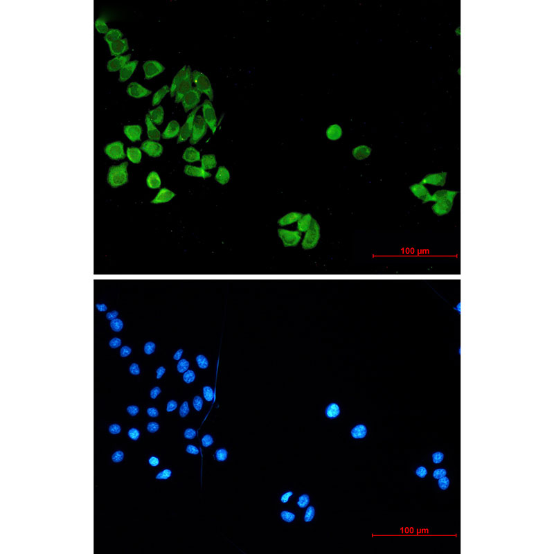 Cleaved-Caspase 8 Mouse mAb ABZ3888