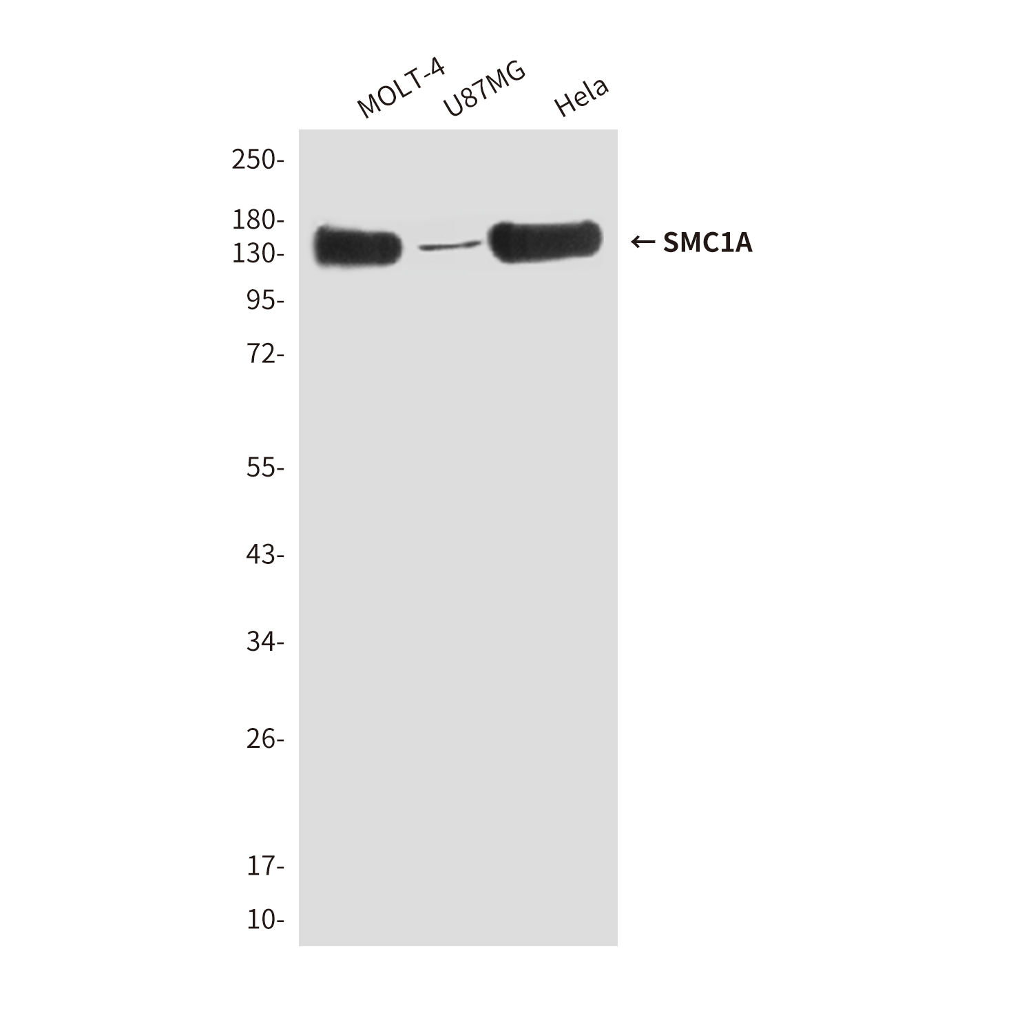 SMC1A (4C5) Mouse mAb ABZ3889
