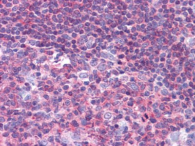 PTK2B (4B4) Mouse mAb ABZ3891