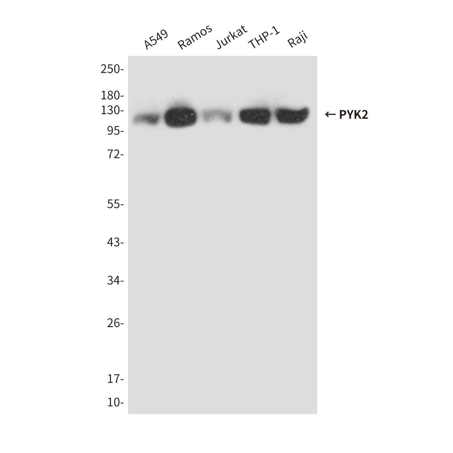 PTK2B (4B4) Mouse mAb ABZ3891