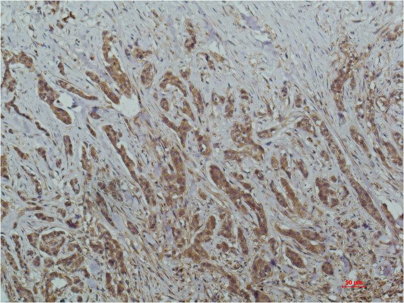 HDAC1 (3F5) Mouse mAb ABZ3892