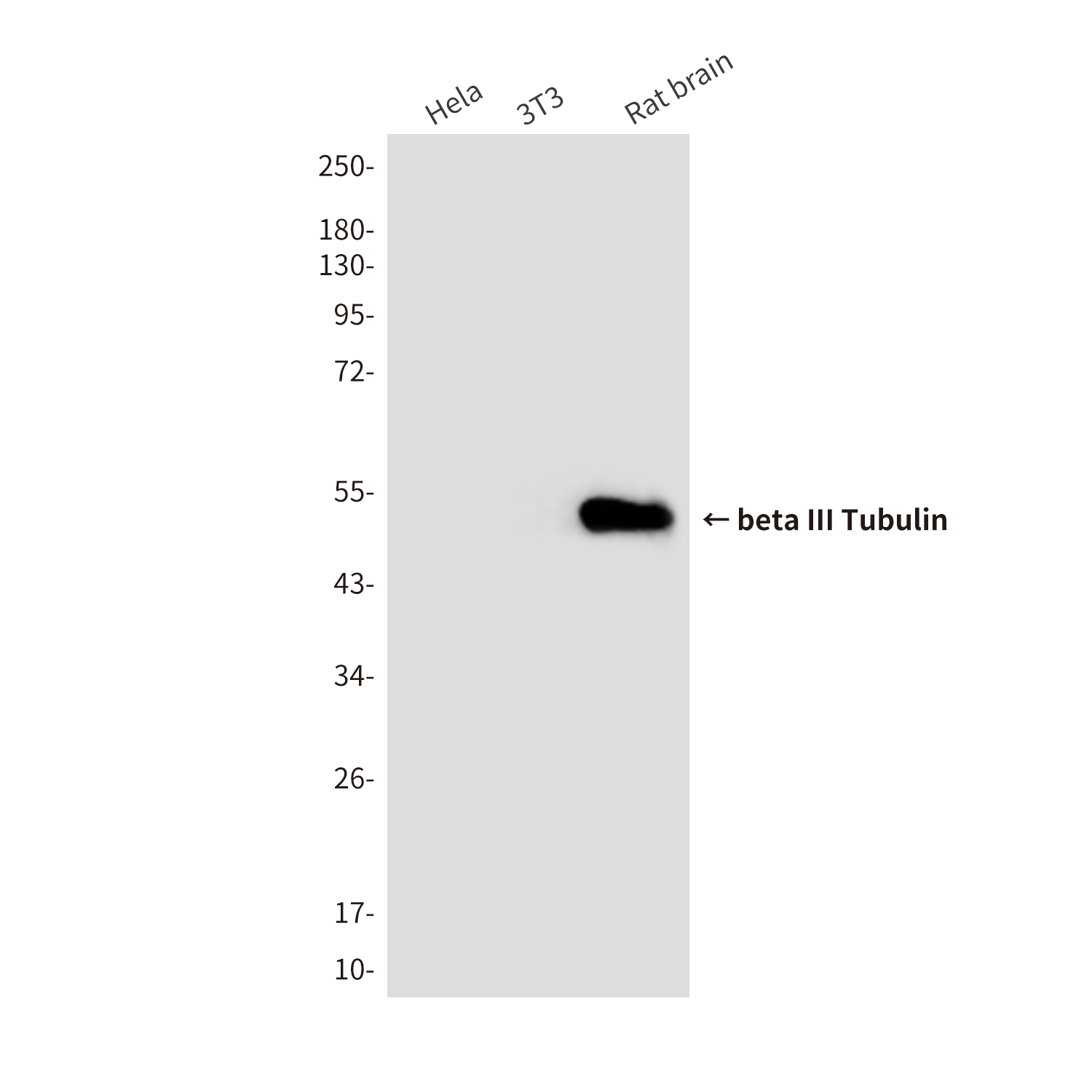 beta III Tubulin (3H2) Mouse mAb ABZ3894