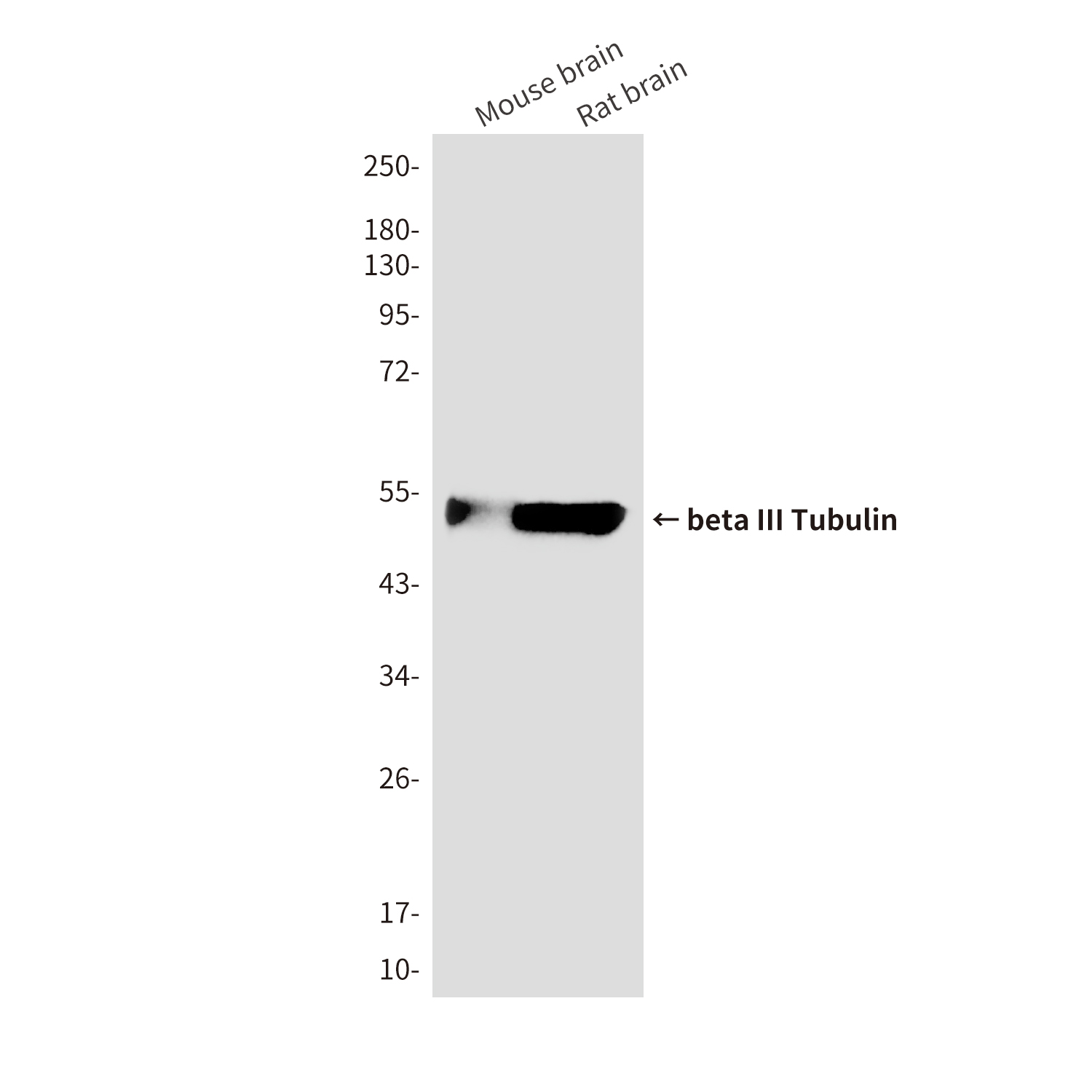 beta III Tubulin (3H2) Mouse mAb ABZ3894