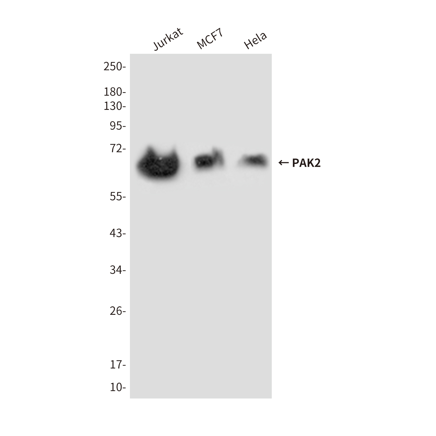 PAK2 (7H3) Mouse mAb ABZ3900