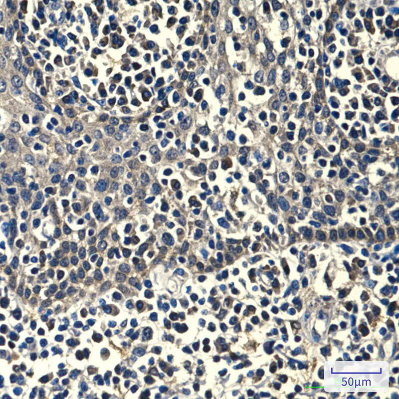 Peroxiredoxin 1/PAG (6A6) Mouse mAb ABZ3903