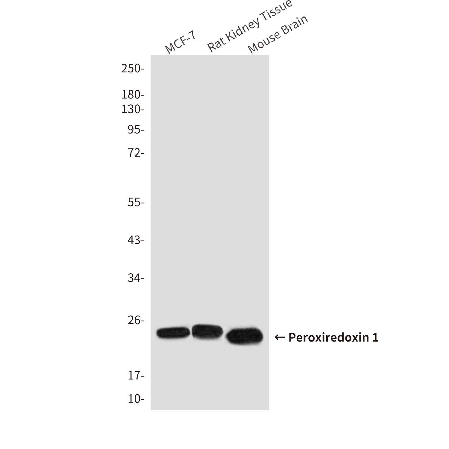 Peroxiredoxin 1/PAG (6A6) Mouse mAb ABZ3903