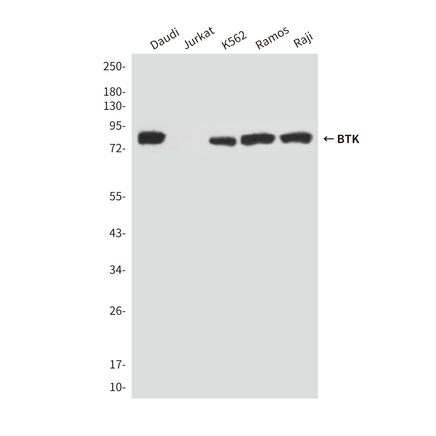 BTK (5B12) Mouse mAb ABZ3905