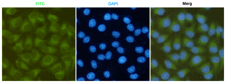 FAK (3D8) Mouse mAb ABZ3906