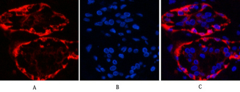 Cytokeratin 17 (8C6) Mouse mAb ABZ3909