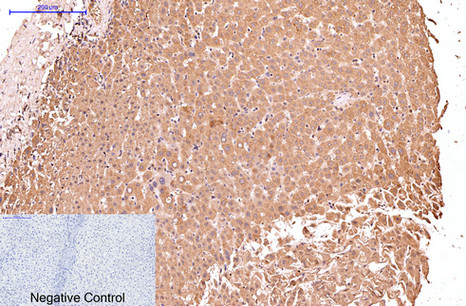 Cytokeratin 17 (8C6) Mouse mAb ABZ3909