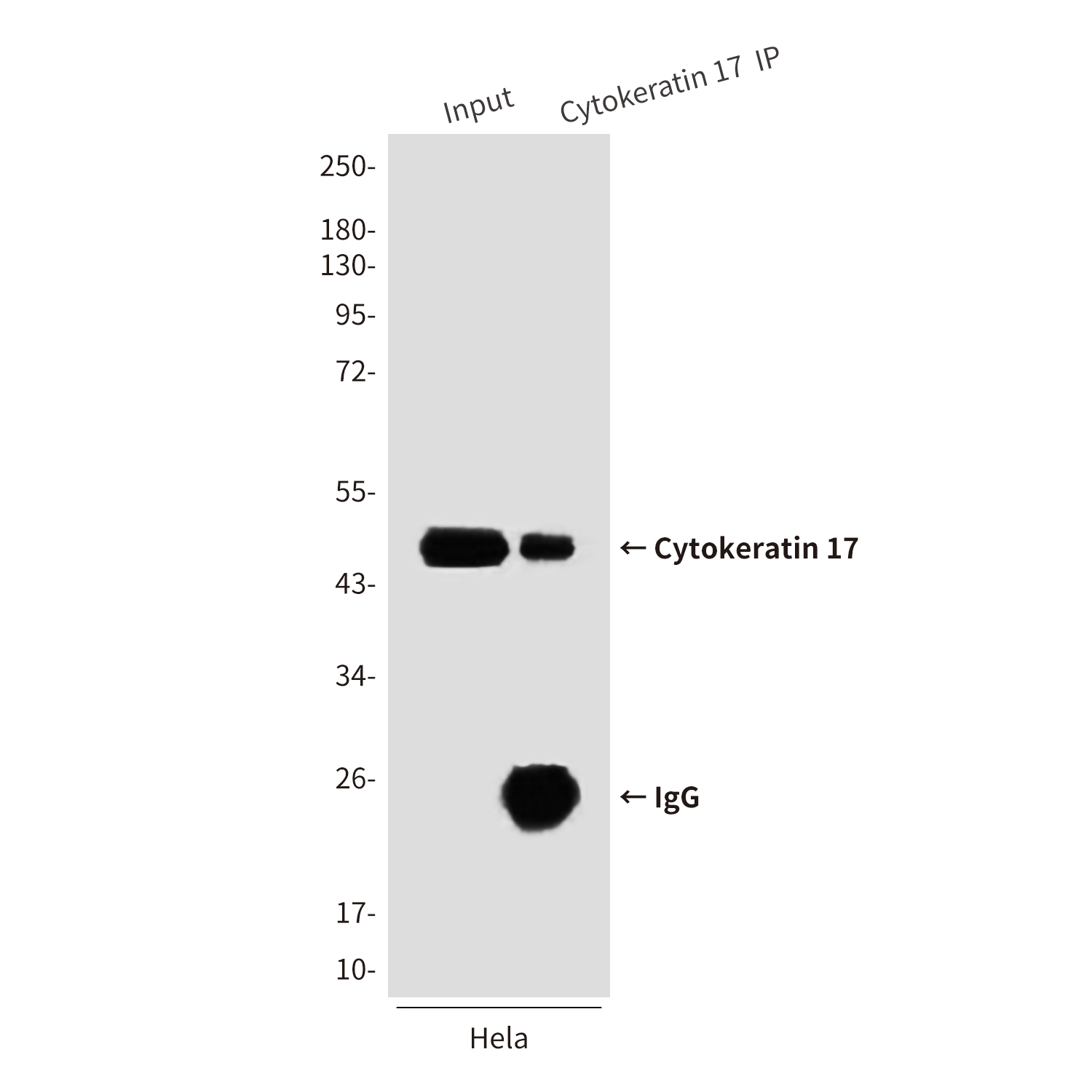 Cytokeratin 17 (8C6) Mouse mAb ABZ3909