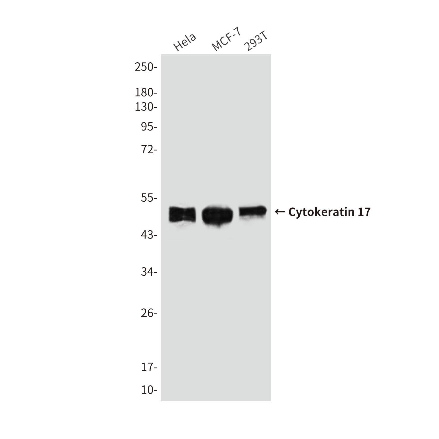 Cytokeratin 17 (8C6) Mouse mAb ABZ3909